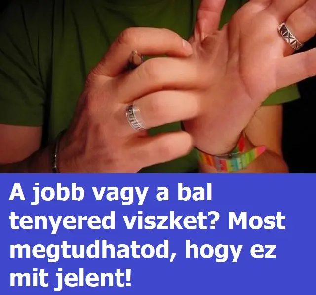 tenyerviszketes
